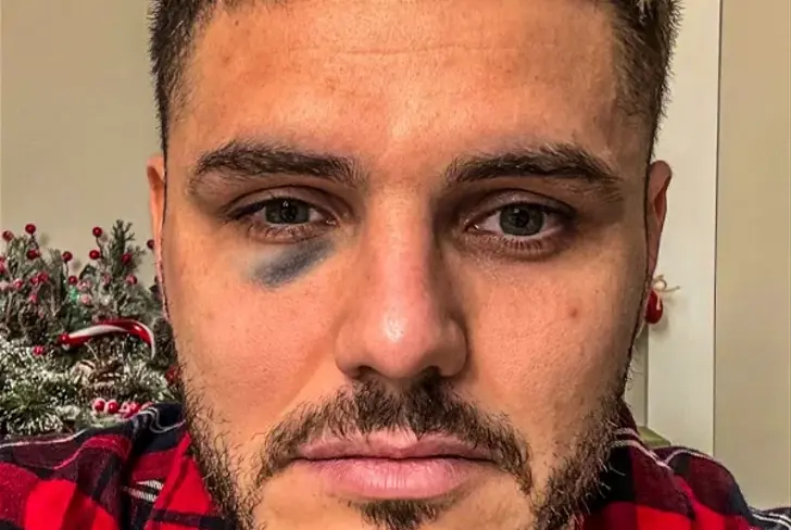 Vía X: Mauro Icardi