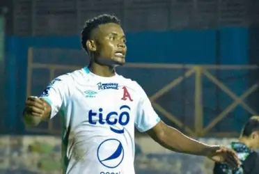 El proceso de recuperación para el delantero colombiano se estima en aproximadamente cuatro semanas, a partir del día de la lesión